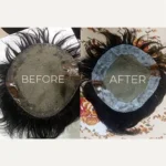 Hair Patch Border Repair Kit 60ML - Image 3